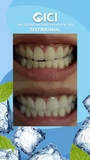 CICI OSMY Teeth & Oral Care